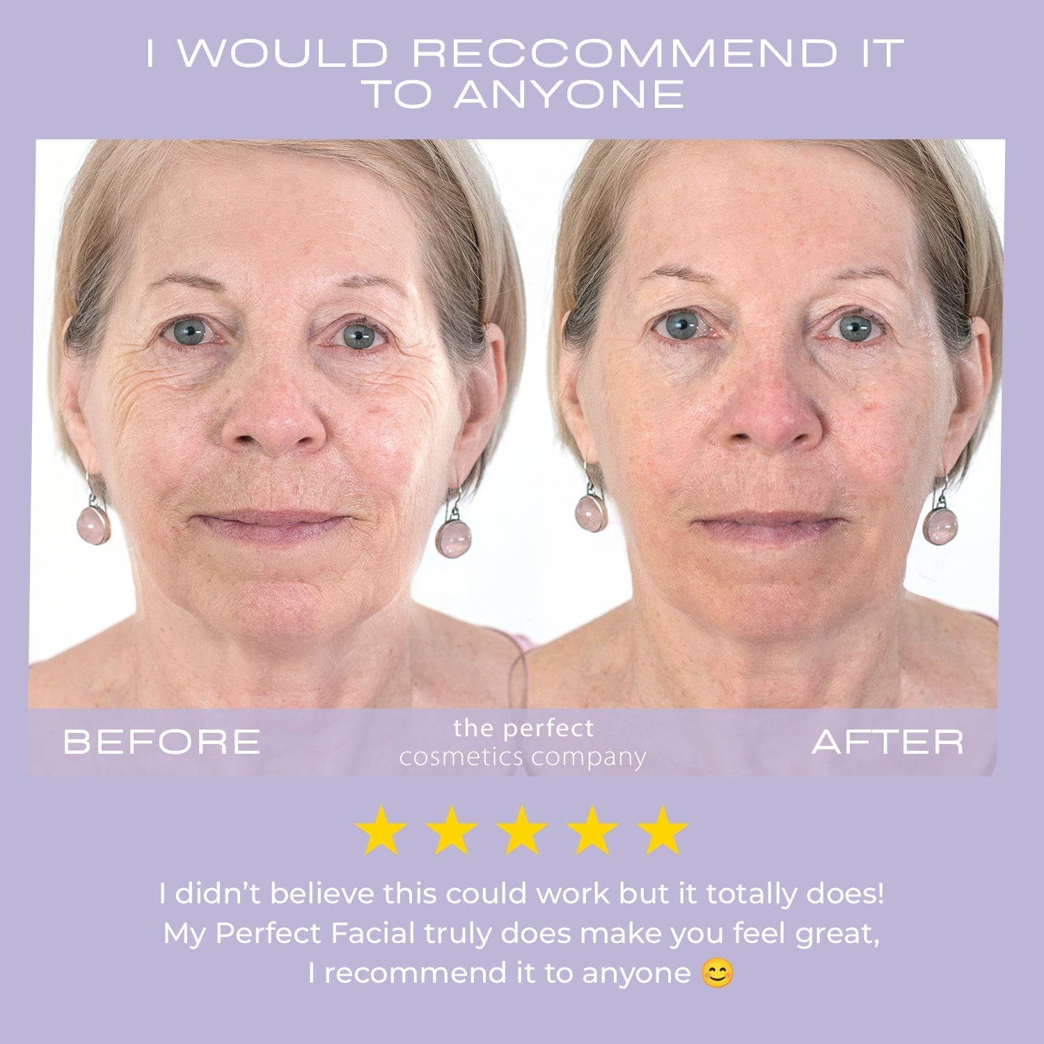 MY PERFECT FACIAL TV OFFER